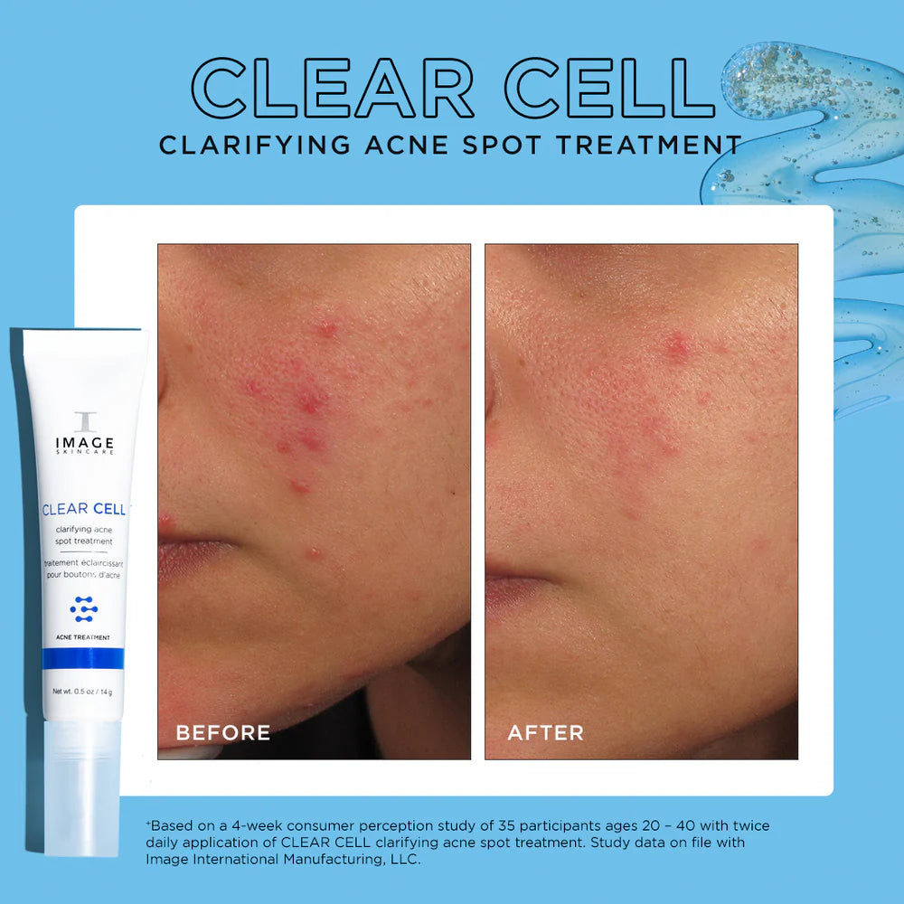 CLEAR CELL clarifying acne spot treatment- Retail size (0.5 oz / 14 g)