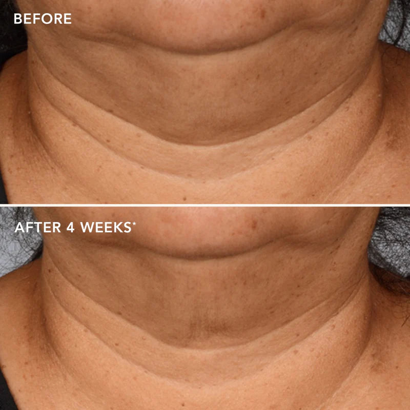 MAX™ neck lift- Retail size (2 oz/59 mL)